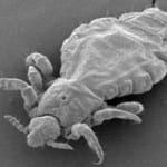 Pest Control Lice Killer